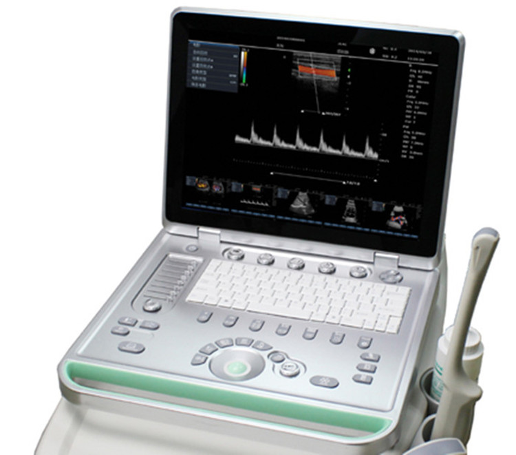 C5Plus型彩色多普勒超声诊断系统